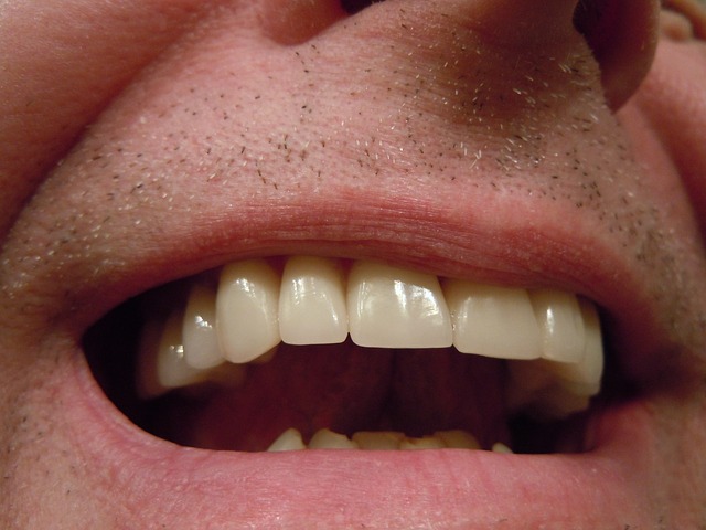 Rovné zuby
